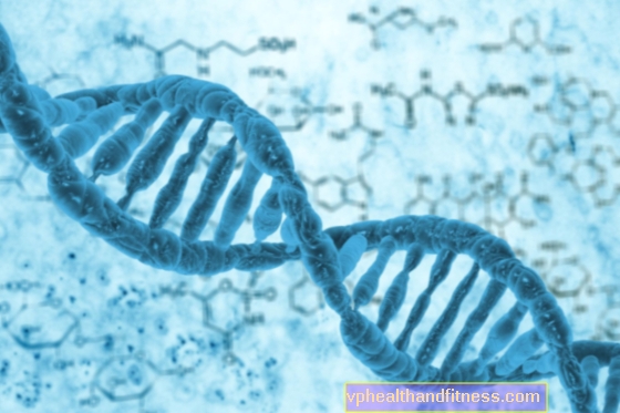 Beals-Syndrom - Ursachen, Symptome, Behandlung