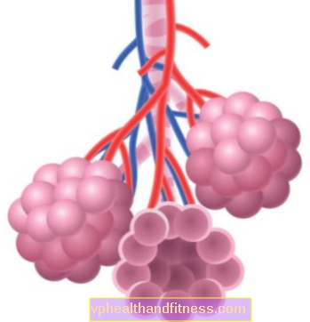 Sindrome di Eisenmenger: cause, sintomi e trattamento della malattia vascolare polmonare