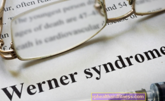 Werner-syndroom - oorzaken, symptomen, diagnose, behandeling