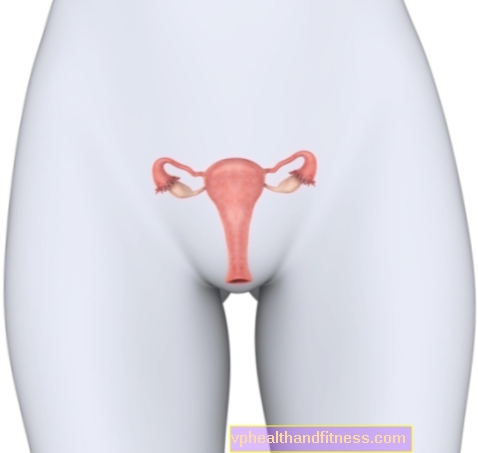 Estrechamiento (atresia) del cuello uterino externo